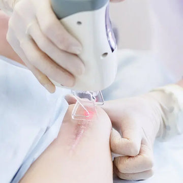 Scar-Reduction Treatment